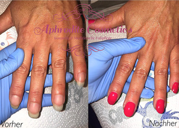 aphrodite cosmetics leistungen 11