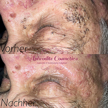 aphrodite cosmetics leistungen 3