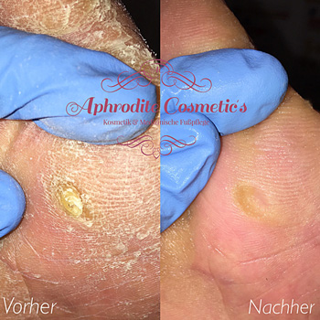 aphrodite cosmetics leistungen 7