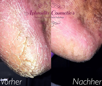 aphrodite cosmetics leistungen 9